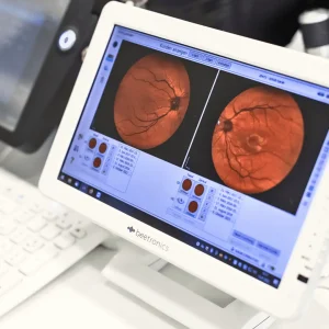 Schütt Optik Hörakustik Ludwigsburg Augenscreening Titel