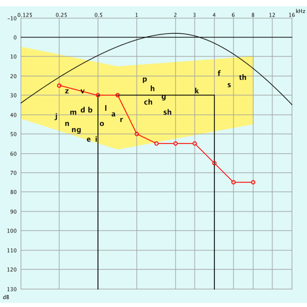 Schütt Optik Hörakustik Ludwigsburg Audiogramm