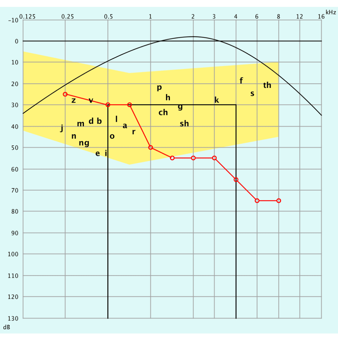 Schütt Optik Hörakustik Ludwigsburg Audiogramm