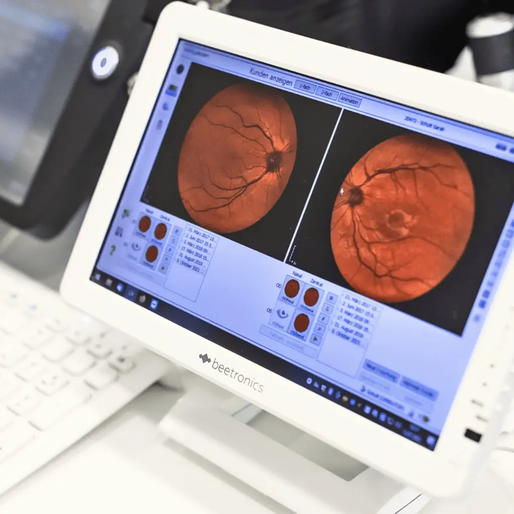 Schütt Optik Hörakustik Ludwigsburg Augenscreening Titel