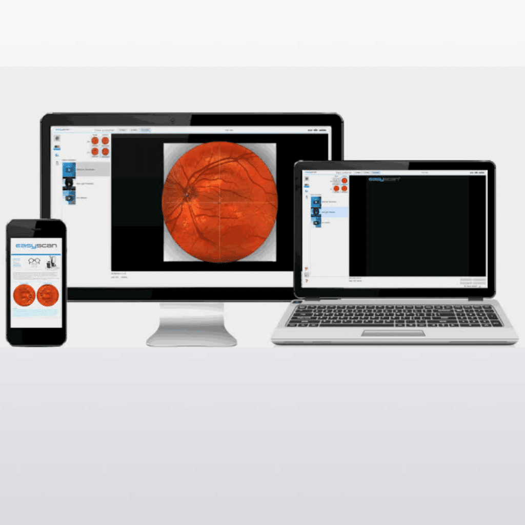 SCHÜTT Optik Hörakustik Ludwigsburg Augenscreening