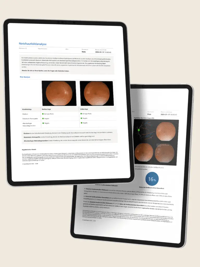 Schütt Optik Hörakustik Ludwigsburg Netzhautbildanalyse